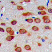 COX4-1 Rabbit Polyclonal Antibody