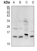COX7A2/3 Rabbit Polyclonal Antibody