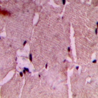COX7A2/3 Rabbit Polyclonal Antibody