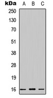 Cystatin 1 Rabbit Polyclonal Antibody