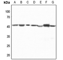 CTBP1 Rabbit Polyclonal Antibody