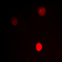 CTBP1 Rabbit Polyclonal Antibody