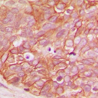 Beta-catenin (Phospho-S33) Antibody