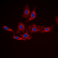 Beta-catenin (Phospho-S33) Antibody