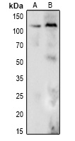 DDX24 Rabbit Polyclonal Antibody