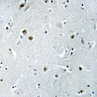 DDX24 Rabbit Polyclonal Antibody