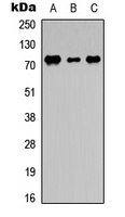 DDX3Y Rabbit Polyclonal Antibody