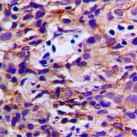DDX3Y Rabbit Polyclonal Antibody