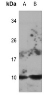 DYNLL2 Rabbit Polyclonal Antibody