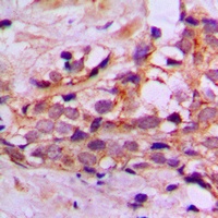 DYNLL2 Rabbit Polyclonal Antibody