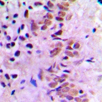 E2F1 Rabbit Polyclonal Antibody