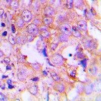 EEF2 (Phospho-T56) Antibody