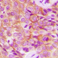 EGFR (Phospho-T693) Antibody