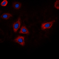 EGFR (Phospho-T693) Antibody