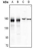 EGFR Antibody [KO/KD Validated]