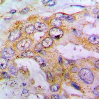 EIF4G1 (Phospho-S1148) Antibody