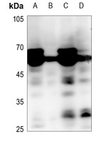MEN Rabbit Polyclonal Antibody
