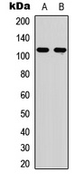 EPHA6 Rabbit Polyclonal Antibody