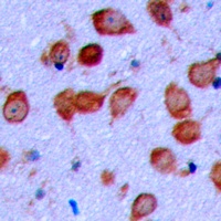 EPHA6 Rabbit Polyclonal Antibody