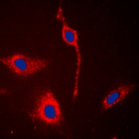 EPHA6 Rabbit Polyclonal Antibody