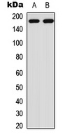 HER2 (Phospho-Y1221/Y1222) Antibody