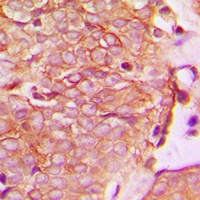 HER2 (Phospho-Y1221/Y1222) Antibody