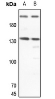ERCC5 Rabbit Polyclonal Antibody