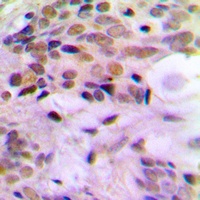 ERCC5 Rabbit Polyclonal Antibody