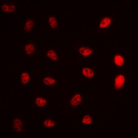 ERCC5 Rabbit Polyclonal Antibody