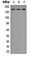ERCC6 Antibody