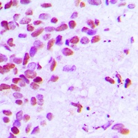 Estrogen Receptor alpha (Phospho-S106) Antibody