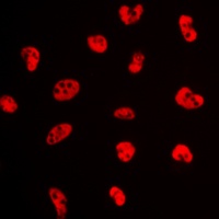 Estrogen Receptor alpha (Phospho-S106) Antibody