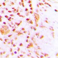 ETV4 Rabbit Polyclonal Antibody