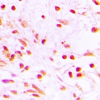 FOSL1 Rabbit Polyclonal Antibody