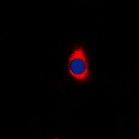GABBR1 Rabbit Polyclonal Antibody