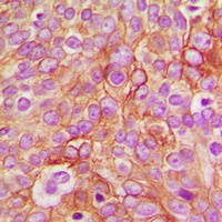 GABRB1 (Phospho-S434) Antibody