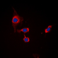 GABRB1 (Phospho-S434) Antibody