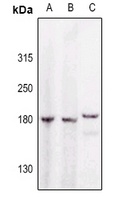 GAK Rabbit Polyclonal Antibody