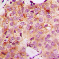 GAK Rabbit Polyclonal Antibody