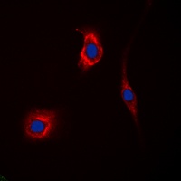 GAK Rabbit Polyclonal Antibody