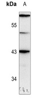 GATA1 (Phospho-S310) Rabbit Polyclonal Antibody