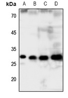 GCLM Rabbit Polyclonal Antibody