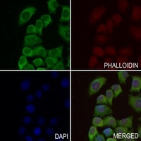 GCLM Rabbit Polyclonal Antibody