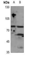 GIT2 Rabbit Polyclonal Antibody