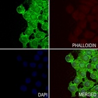 GIT2 Rabbit Polyclonal Antibody