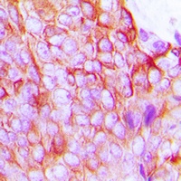 Connexin 43 (Phospho-S368) Antibody