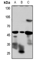 GLP-1 Receptor Antibody