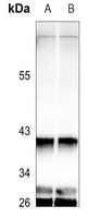 GNAT1 Rabbit Polyclonal Antibody