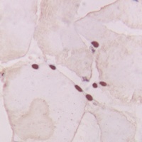 GNAT1 Rabbit Polyclonal Antibody
