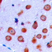 NMDAR1 Rabbit Polyclonal Antibody